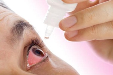 Đau mắt đỏ: Rửa mắt theo cách này sẽ nhanh khỏi hơn