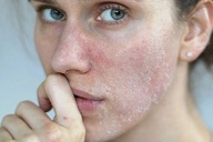 Thận yếu da có thể xuất hiện 6 triệu chứng lạ mà quen này