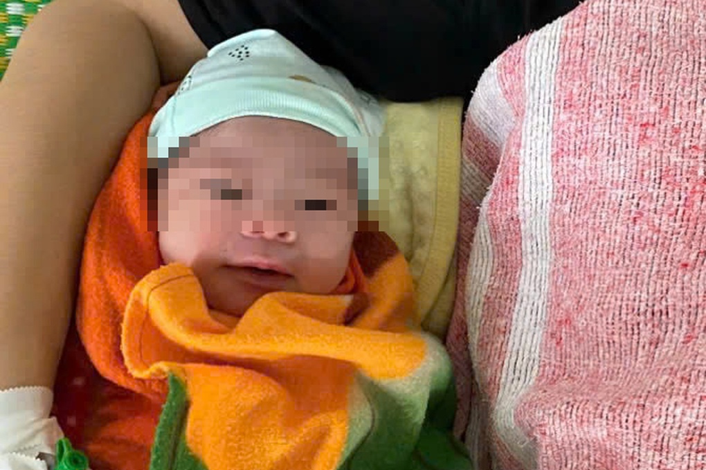 Rarely, a newborn baby boy was born with the umbilical cord wrapped 6 times around his neck - 1 Hy hữu, bé trai sơ sinh chào đời với dây rốn quấn 6 vòng quanh cổ - 1
