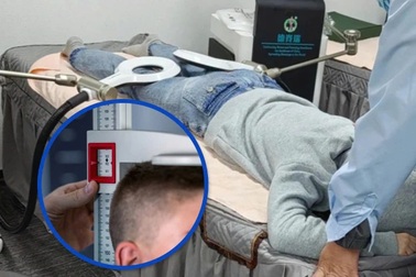 Chàng trai chi 2.300 USD đi kéo dài cơ thể, bất ngờ bị "co" lại sau 2 tuần