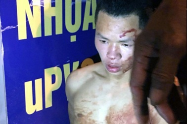 Tài xế taxi bị cướp cứa cổ đã qua cơn nguy kịch