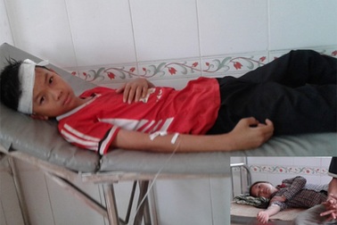 Quạt trần rơi trong giờ học, 2 học sinh bị thương