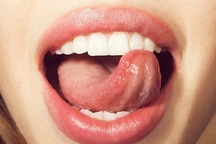 Ung thư lưỡi ngày càng phổ biến, bác sĩ cảnh báo 4 nguyên nhân gây bệnh