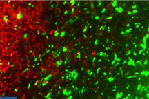 Phương pháp chỉnh sửa gen để đối phó với ung thư