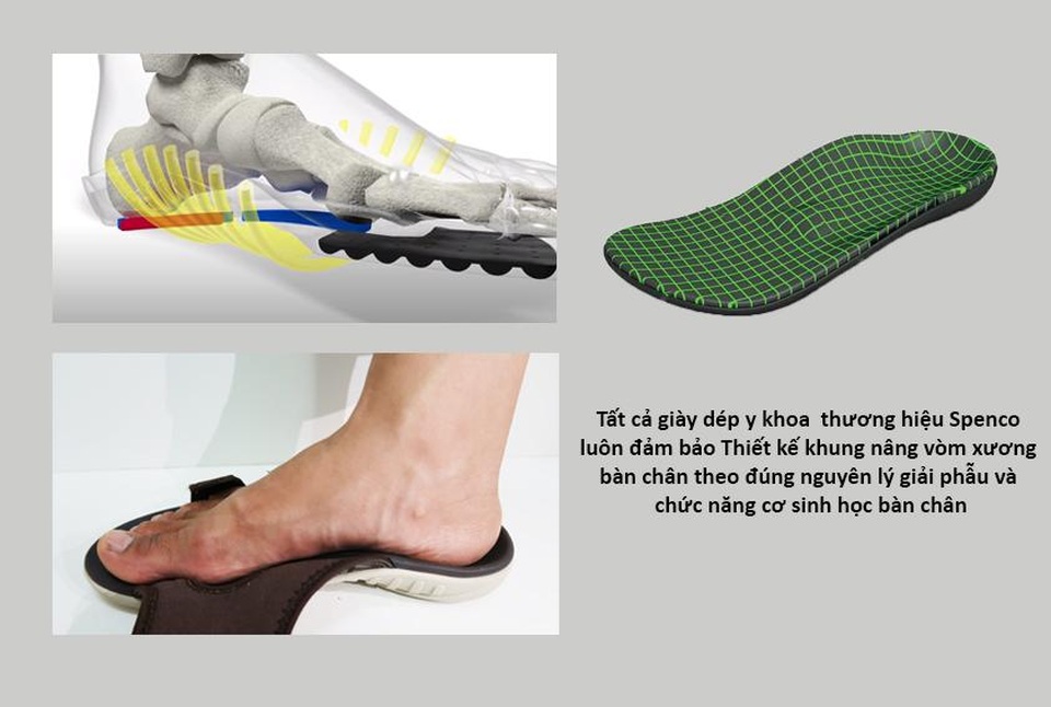 Hậu quả khi sử dụng giày dép chỉnh hình chân bẹt kém chất lượng và tác hại khôn lường - 5 Hậu quả khi sử dụng giày dép chỉnh hình chân bẹt kém chất lượng và tác hại khôn lường - 5