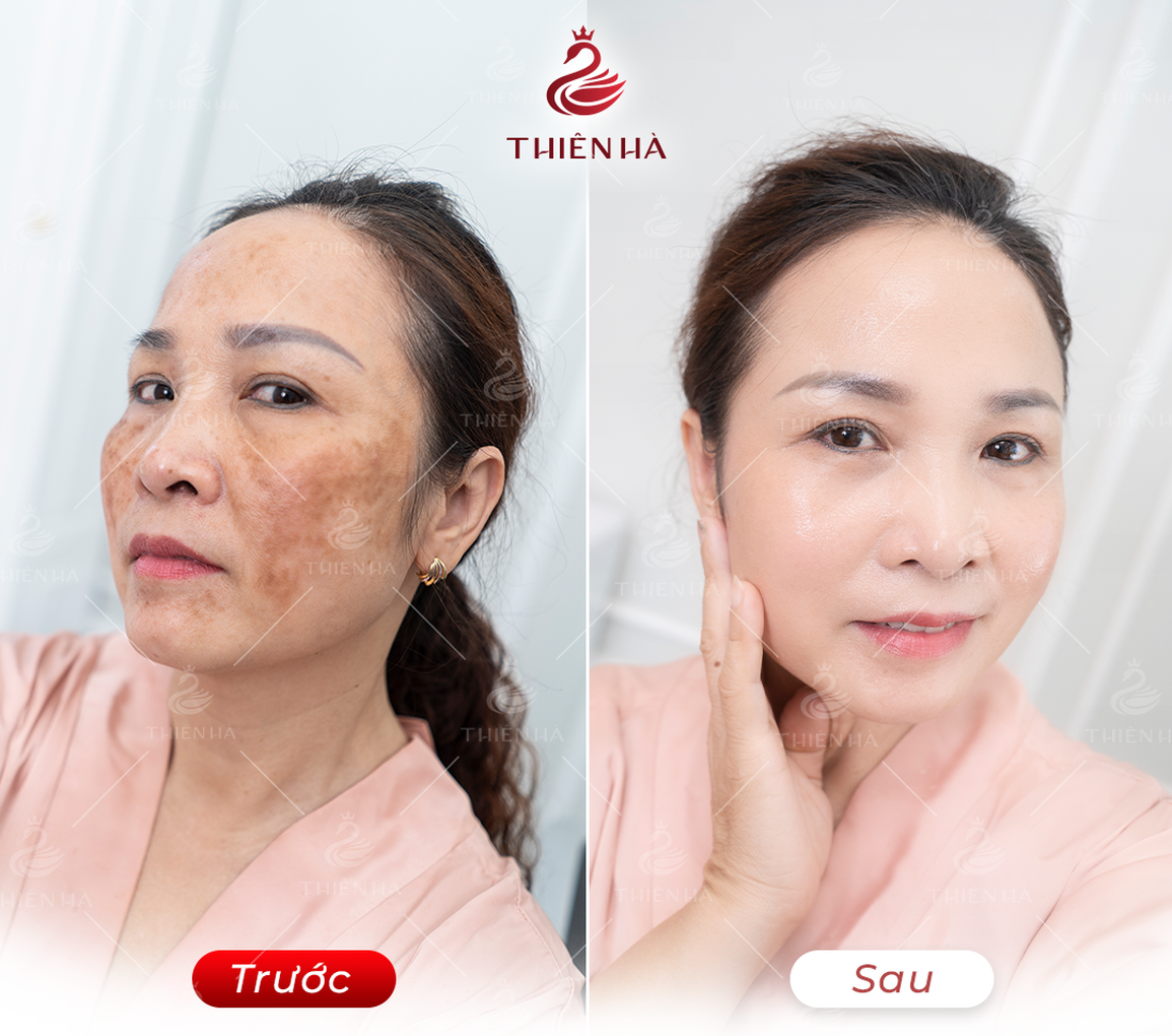Chuẩn y khoa trong làm đẹp là gì? - 2 Chuẩn y khoa trong làm đẹp là gì? - 2