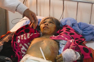 Bạo hành osin như thời trung cổ?