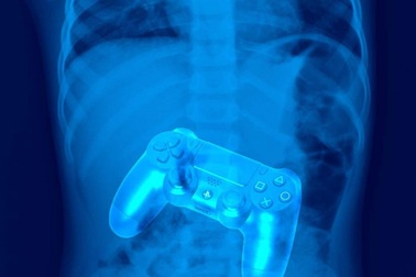 Có thể nuốt “Máy điều khiển”  để chơi trò chơi bằng dạ dày?