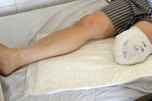 Rùng mình căn bệnh khiến con người tự chặt tay, chân trong vô thức