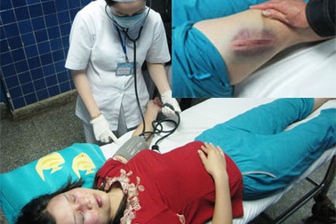 Nữ giáo viên bị chồng cũ hành hung dã man