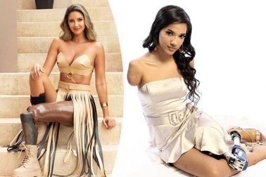 Định mệnh khắc nghiệt của những Hoa hậu, người đẹp bị cưa tay, cưa chân