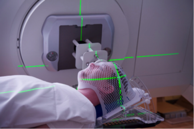 Điều trị toàn bộ đợt xạ trị ung thư chỉ chưa đầy 1 giây
