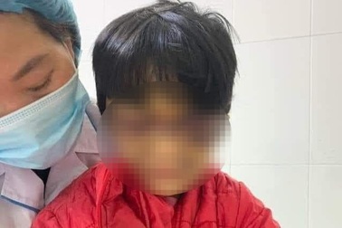 Bé gái 6 tuổi bị mẹ đẻ bạo hành thâm tím mặt mũi, nhốt trong nhà