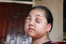 Cuốn bệnh án đẫm nước mắt của người mẹ nghèo có con gái mắc bệnh lạ