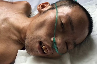 Trao quà đến anh Nguyễn Bá Cường.