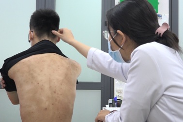 "Tôi tiêm thuốc chưa đầy 1 phút nhưng phải nghỉ nửa buổi làm việc"