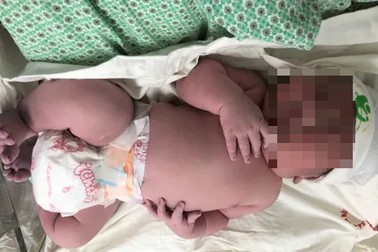 Bác sĩ ngỡ ngàng khi bé trai bụ bẫm vừa chào đời đã nặng... 5,2kg