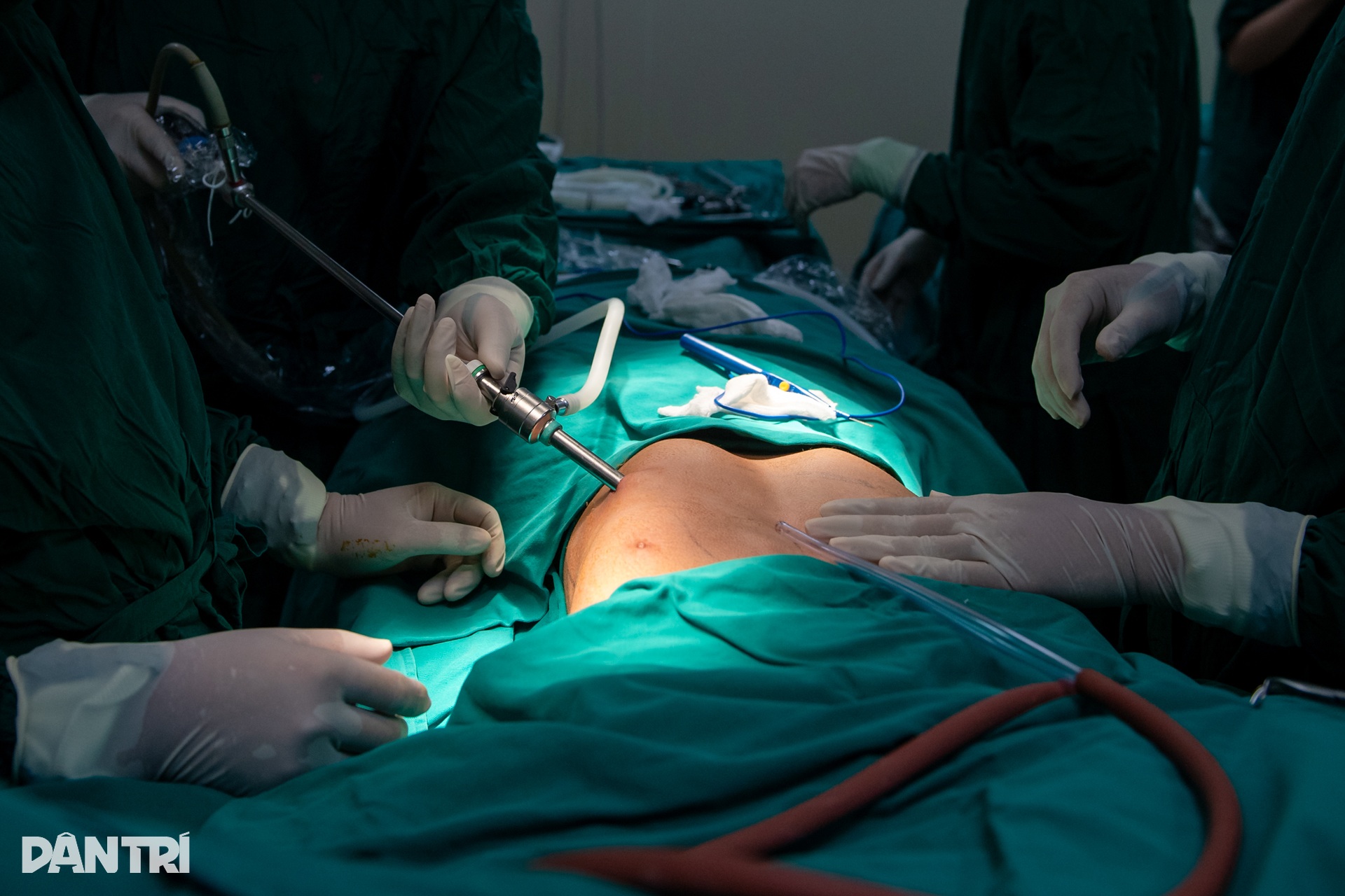 Xem bác sĩ dùng thanh titan uốn xương cho chàng trai lõm ngực - 6