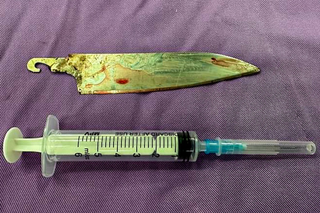 Cứu sống nam thanh niên bị đâm dao vào đầu - 2 Cứu sống nam thanh niên bị đâm dao vào đầu - 2