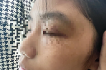 Tạm dừng học với nhóm nữ sinh đánh bạn đến co giật