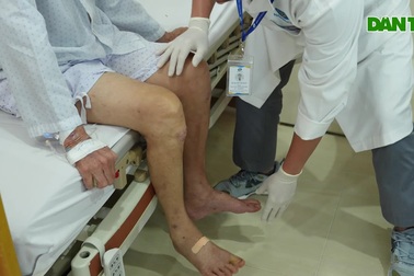 Người đàn ông Lâm ở Đồng xúc động khi được bác sĩ cứu thoát cảnh tàn phế