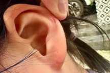 Vụ cô giáo "tác động vật lý": Nhiều học sinh bị xoắn tai, đánh vào đầu