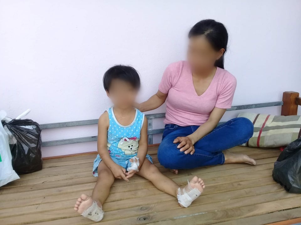 Nghi án bé gái bị cha dượng đánh đập, dí người vào ống pô nóng - 1 Nghi án bé gái bị cha dượng đánh đập, dí người vào ống pô nóng - 1