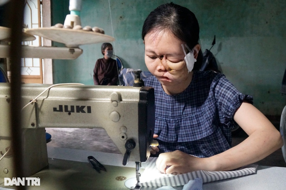 Cô gái đau khổ bởi hễ ra đường là trẻ con vừa thấy đã khóc thét, bỏ chạy - 2 Cô gái đau khổ bởi hễ ra đường là trẻ con vừa thấy đã khóc thét, bỏ chạy - 2