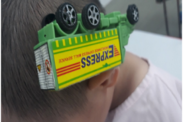 Bé trai 3 tuổi bị xe đồ chơi cắm vào đầu