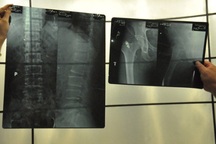 Khi bác sỹ “ăn phim” X- quang