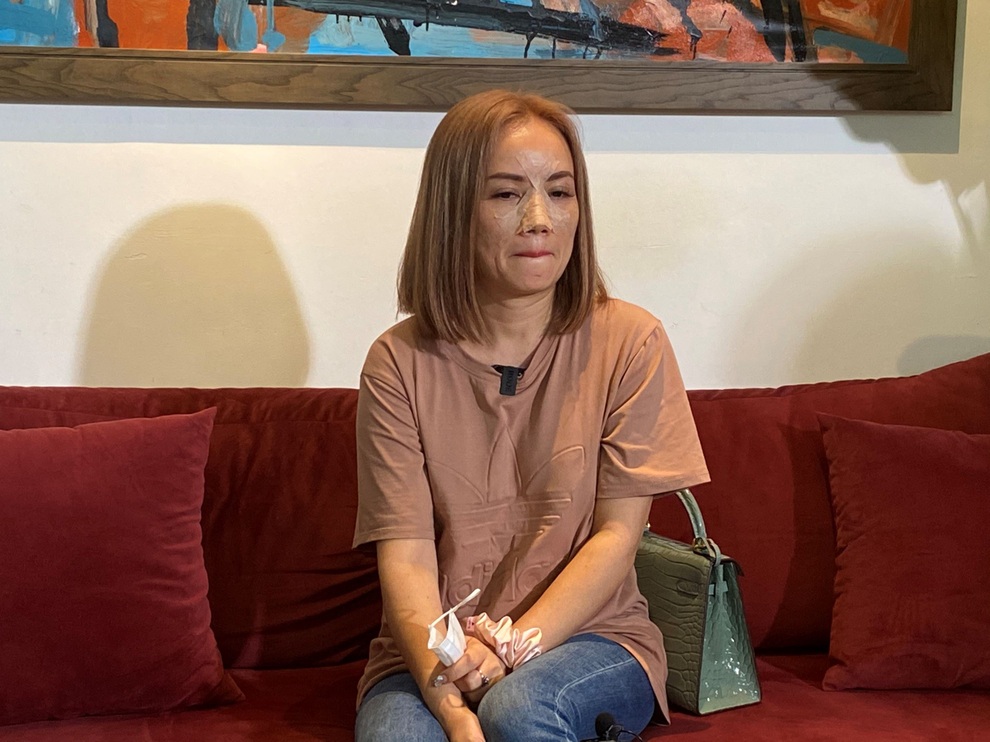 Cô Xuyến Hoàng Yến dán băng chằng chịt sau khi tố chồng cũ đấm gãy mũi - 2 Cô Xuyến Hoàng Yến dán băng chằng chịt sau khi tố chồng cũ đấm gãy mũi - 2