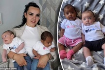 Lạ lùng cặp song sinh cùng cha, cùng mẹ nhưng khác... màu da