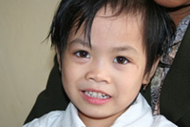 Một học sinh mầm non bị cô giáo đánh xước mặt?