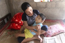 Cha gặp tai nạn, 2 con thơ bị dị tật bẩm sinh rơi vào cảnh đói khát