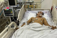 Hết rượu, lấy cồn rửa tay pha loãng để nhậu, 4 người đàn ông nhập viện