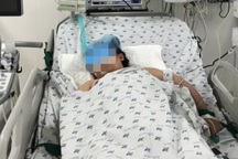 Cảnh báo: Covid-19 tấn công đường tiêu hóa khiến bé gái loét dạ dày nặng