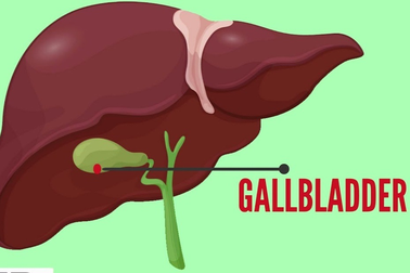 Triệu chứng của polyp túi mật