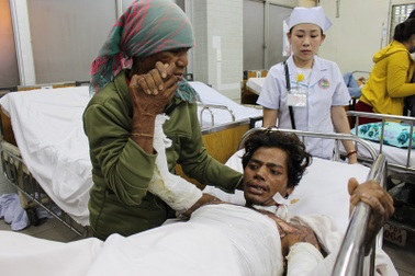 Bỏng nặng vì ngủ say, đạp đổ can xăng