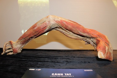 Trưng bày hơn 130 mẫu vật cơ thể người thật