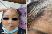 Bệnh cốt tủy viêm xương khiến nhiều người mất mạng nguy hiểm thế nào?