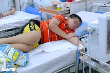 Bé trai thủng trực tràng, vỡ xương vì trò đùa rất hay gặp ở trường học