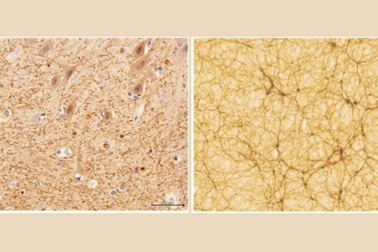 Cấu trúc của não và vũ trụ có những điểm tương đồng đáng ngạc nhiên