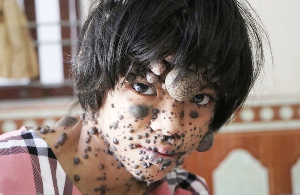 Gặp lại bé gái mơ một ngày được làm thiếu nữ - 3 Gặp lại bé gái mơ một ngày được làm thiếu nữ - 3