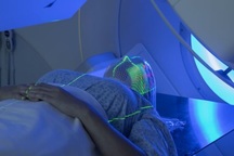 Xạ trị gây nên những tác dụng phụ gì?