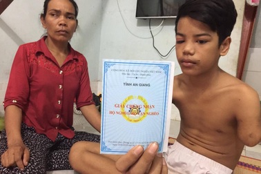 Cậu bé 15 tuổi đi làm công nhân, bị máy cán đứt lìa cánh tay