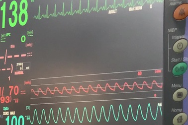 Báo động đỏ cứu bé gái trong vụ tai nạn mất cả cha và mẹ