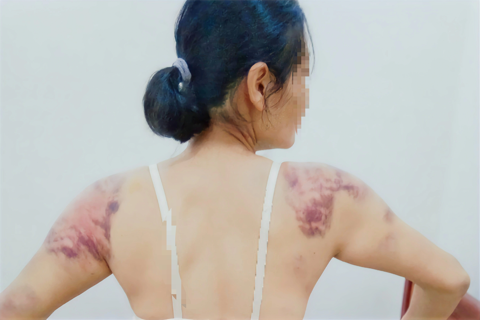 Cuộc trốn chạy khỏi những gã chồng ác quỷ - 1 Cuộc trốn chạy khỏi những gã chồng ác quỷ - 1