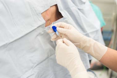 Mũ chụp giúp phát hiện viêm màng não không đau