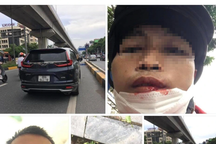 Tài xế xe ôm bị người đàn ông đi ô tô đánh vì "không nhường đường"?