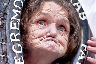 Người phụ nữ có gương mặt xấu “không đỡ nổi”